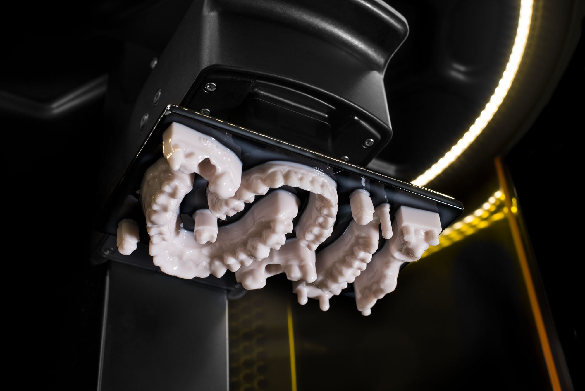 3D Printed Dental Mold/Model