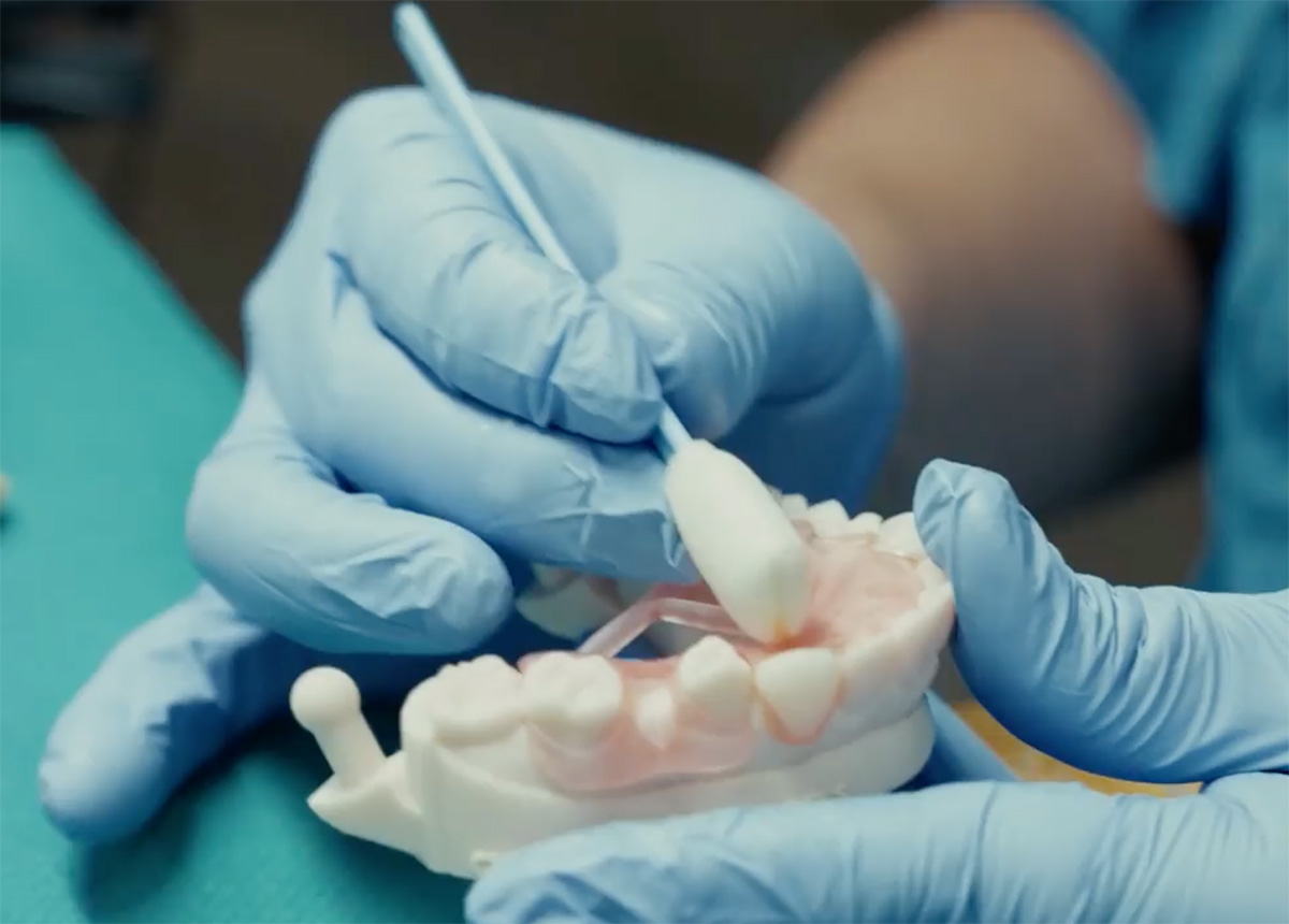 Polishing FP3D denture