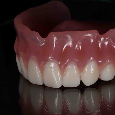 Dentca Upper Denture