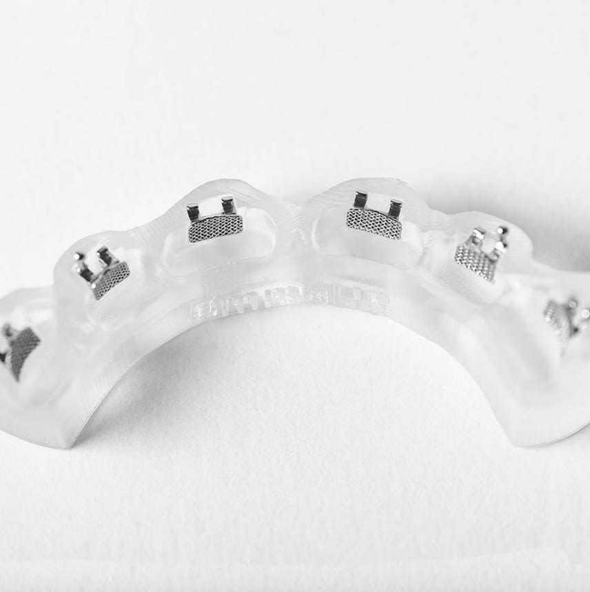 Dreve FotoDent®: Indirect Bonding Tray