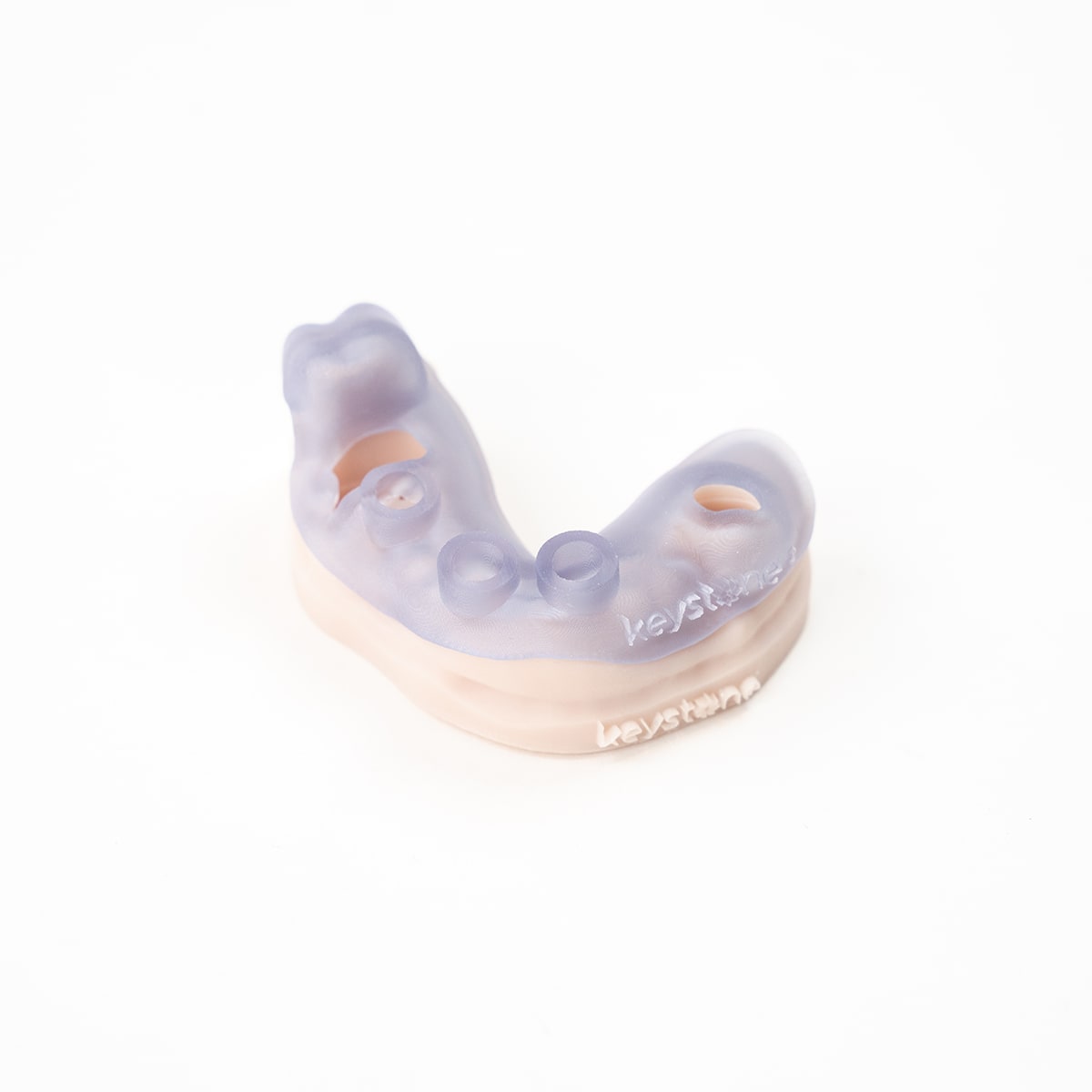 3D Printed Dental Implant Guide