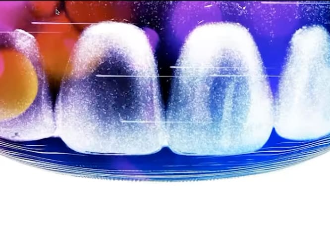 digital teeth
