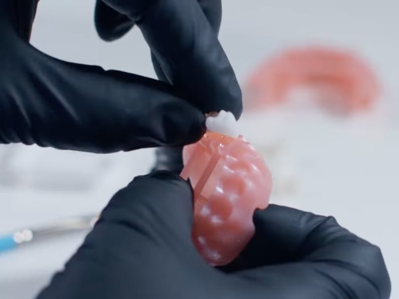 Placing teeth into dentures